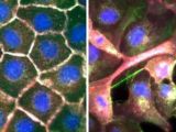 Lung cancer cells have an easy time spreading because they don't stick together