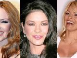 Kylie Minogue, Catherine Zeta Jones and Pamela Anderson seem to have jumped on the fat filler bandwagon