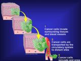 Some 90% of all cancer patients die as a result of metastasis
