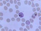 Plasmodium knowlesi as seen with the help of a microscope