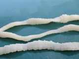 This is what adult tapeworms look like