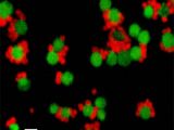 Nanoarchaeum equitans (tiny red cells) attached to its host Ignicoccus spec. (big green cells)