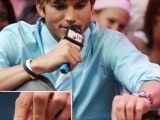 Ashton Kutcher never really hid his webbed toes