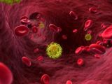 Researchers say HIV is now less virulent than it used to be