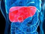 Compound in soap linked to liver fibrosis and cancer