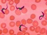 Tripanosomas amongst blood's red cells
