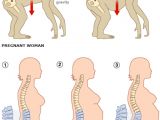 Pressure on the spine in pregnant chimp and pregnant woman