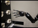 Prosthetic arm with thumb low and extended