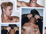 Justin Bieber shows off his cupping marks in Interview spread